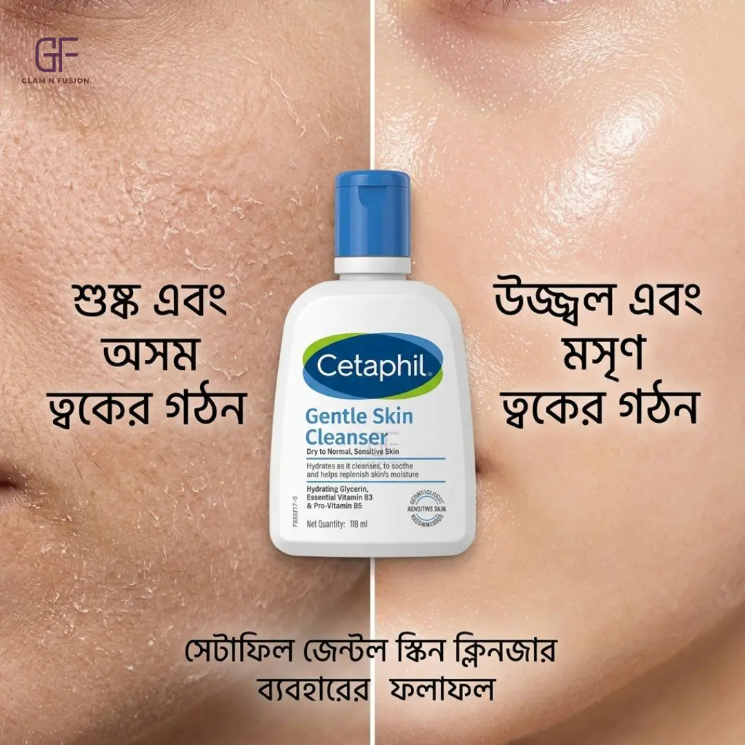 Cetaphil Gentle Skin Cleanser For Dry To Normal, Sensitive Skin 118ml